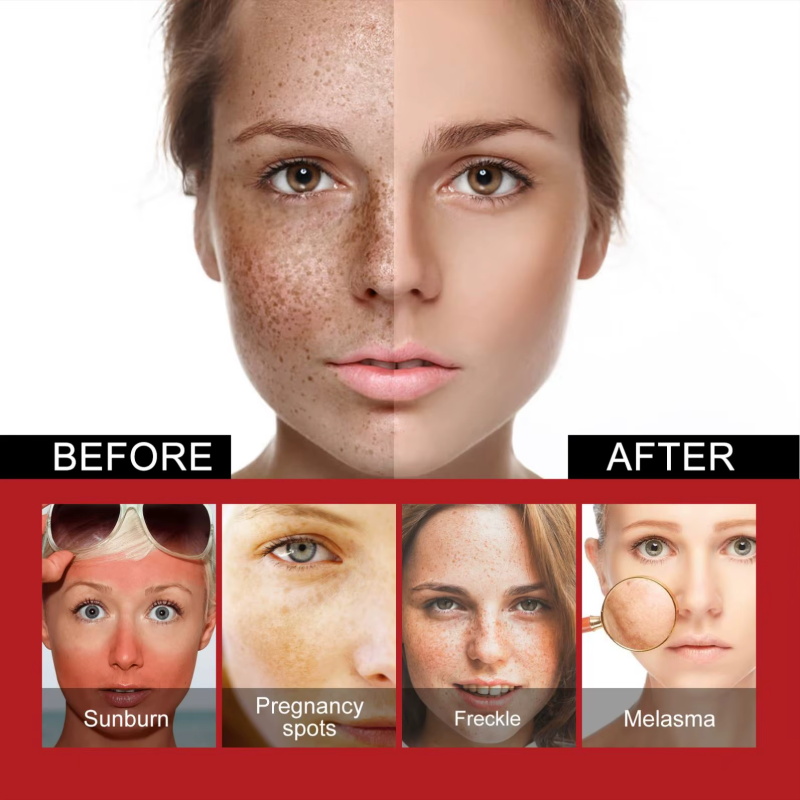 Powerful Spot-Removing Whiten  - огляд і ціна Charcoal Whitening Paste