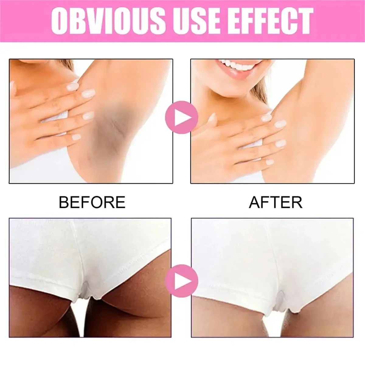 Fast Whitening Dark Knuckles B - огляд і ціна Charcoal Whitening Paste