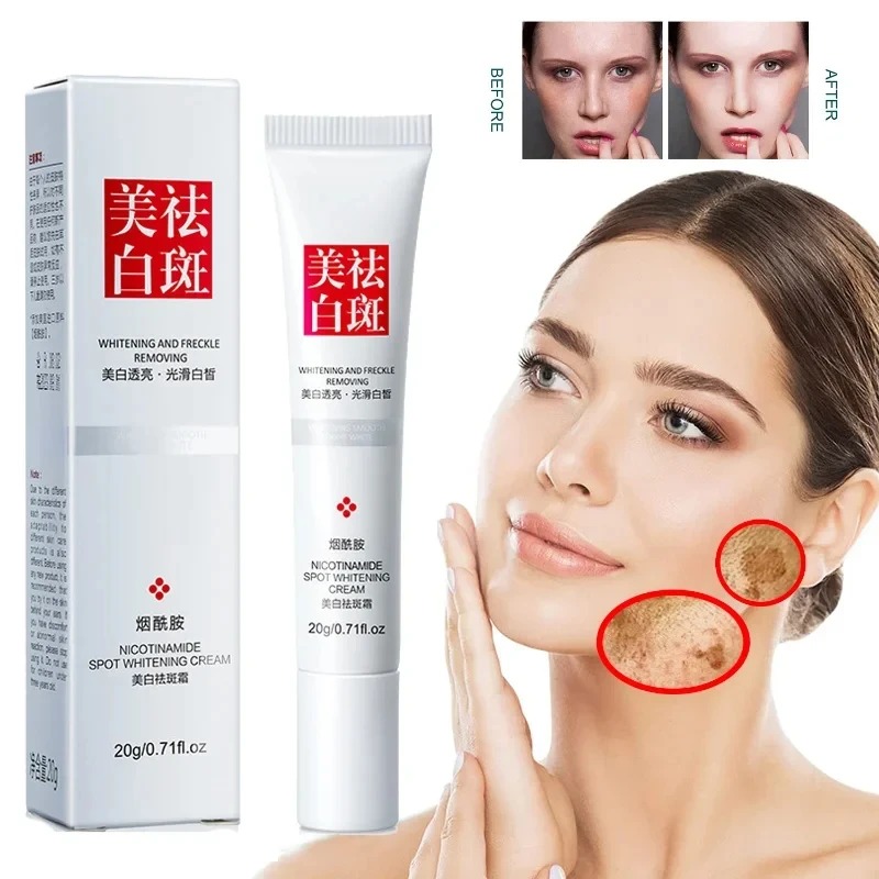 Fade and Improve Freckles Blac - огляд і ціна Charcoal Whitening Paste
