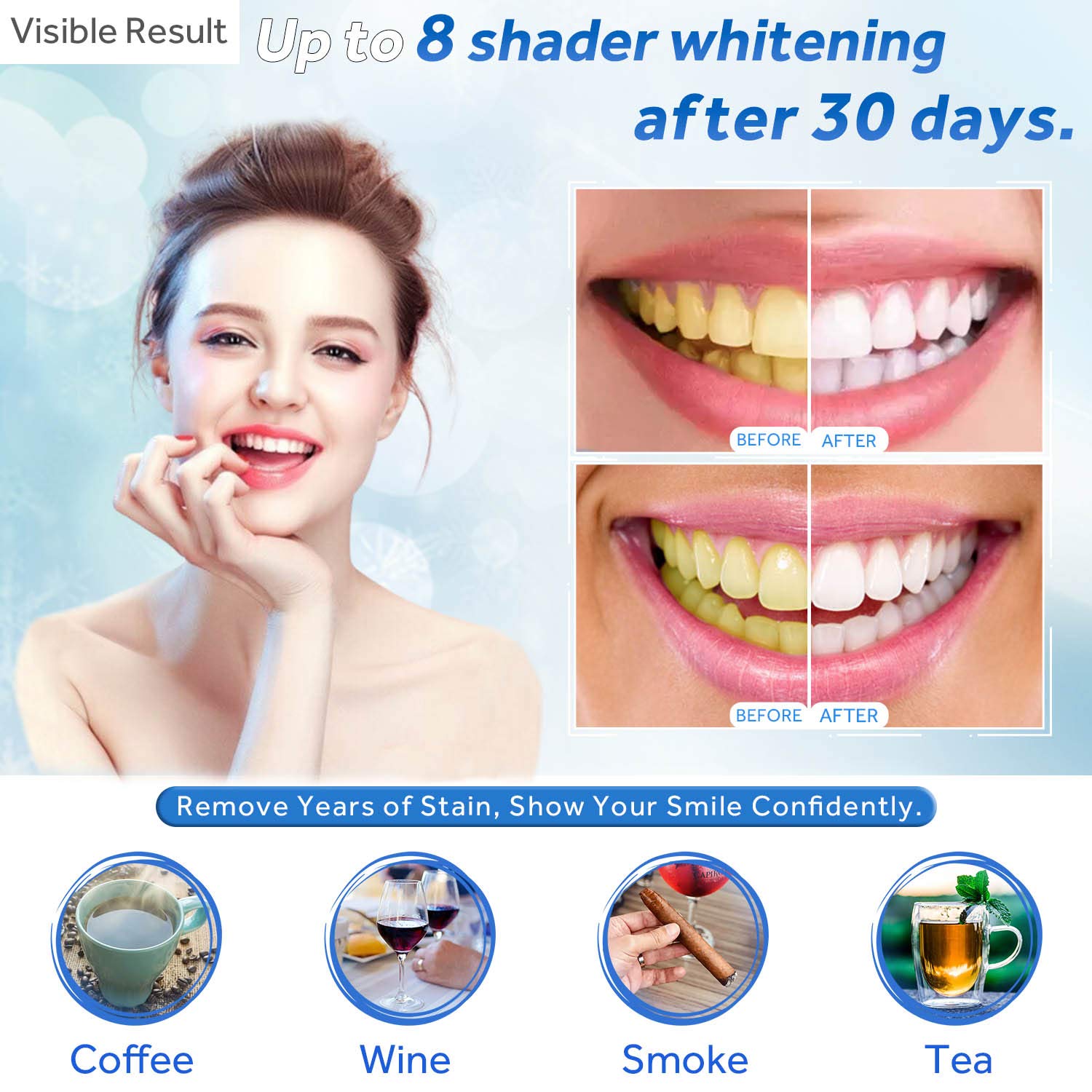 Teeth Whitening Gel Refill Syr - огляд і ціна Teeth Whitening Ulta