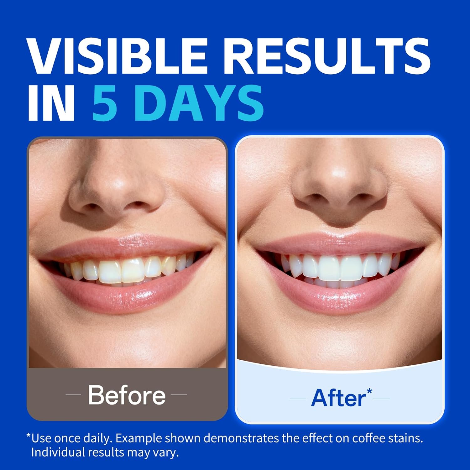 1/7 Pairs Teeth Whitening Stri - огляд і ціна Teeth Whitening Strips Permanent