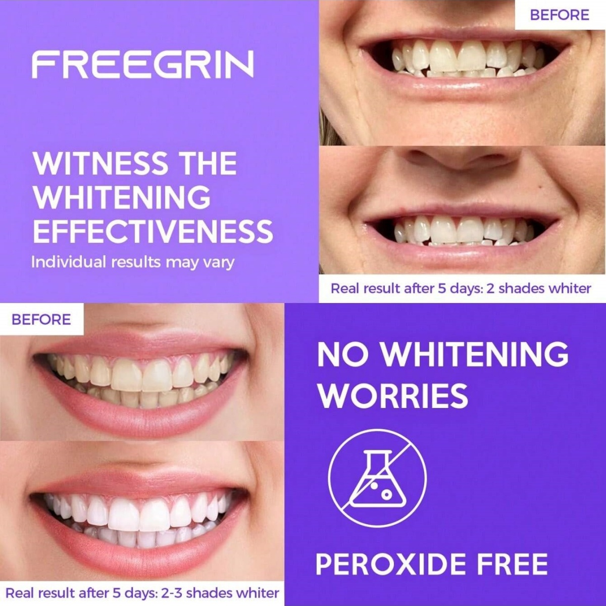 Deluxe Whitening Teeth Sticker - огляд і ціна Teeth Whitening Strips Permanent