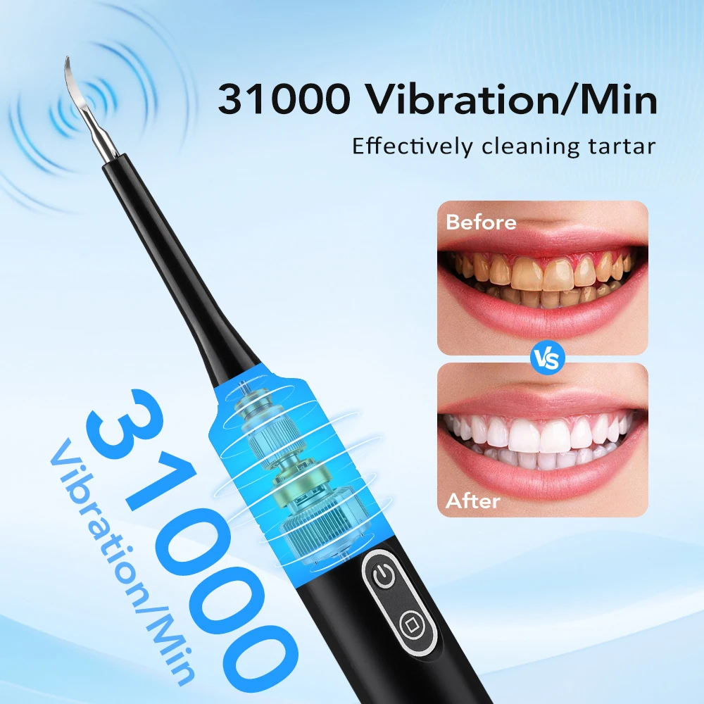 Electric Sonic Vibration Denta - огляд і ціна Teeth Whitening Kit Professional